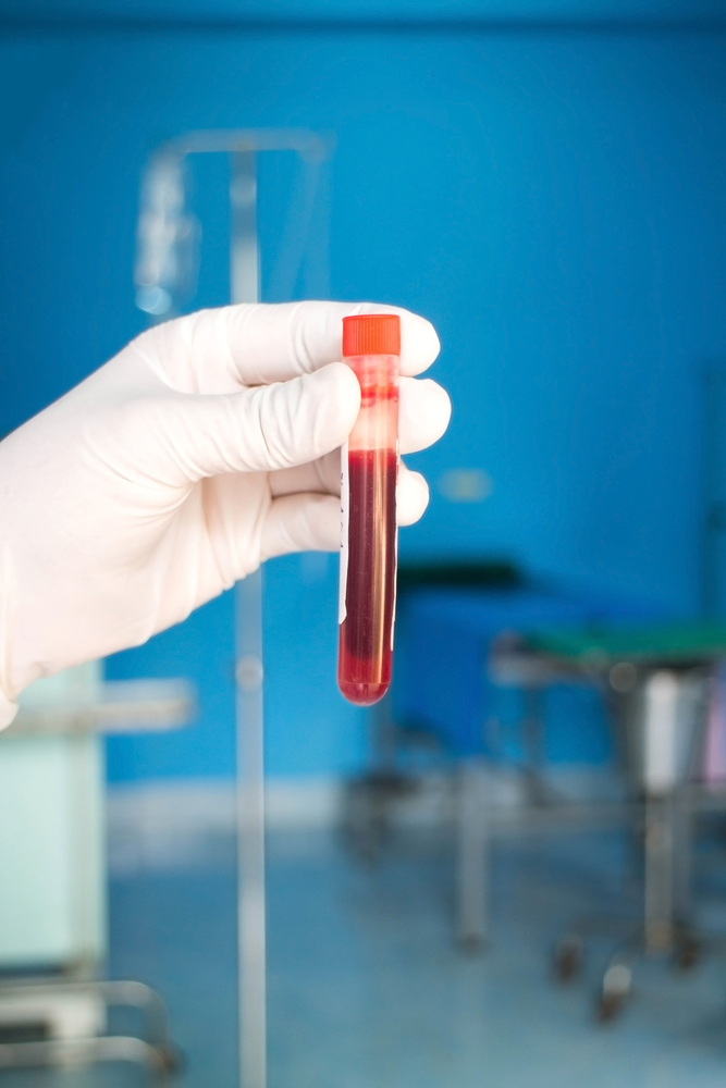 blood test.jpg